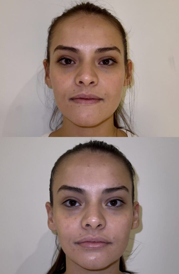 A woman with different facial features and the same face.